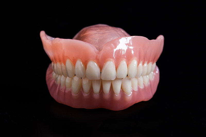 Denture example model