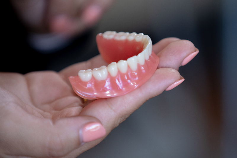 Denture example model