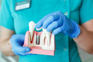 3D illustration of a single-tooth dental implant demonstrates each procedure component—implant, abutment and crown- separately.