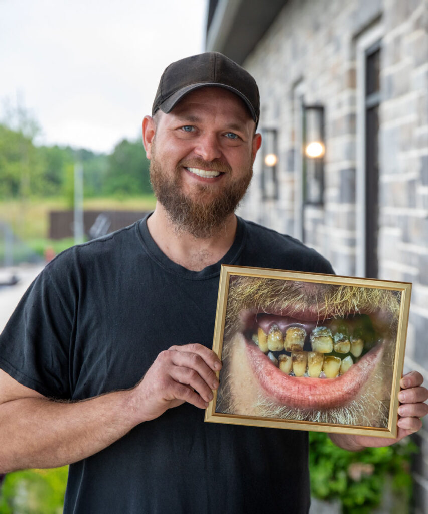 All On 4 Dental Implant Patient James Holding His Before Photo While Smiling With New Teeth