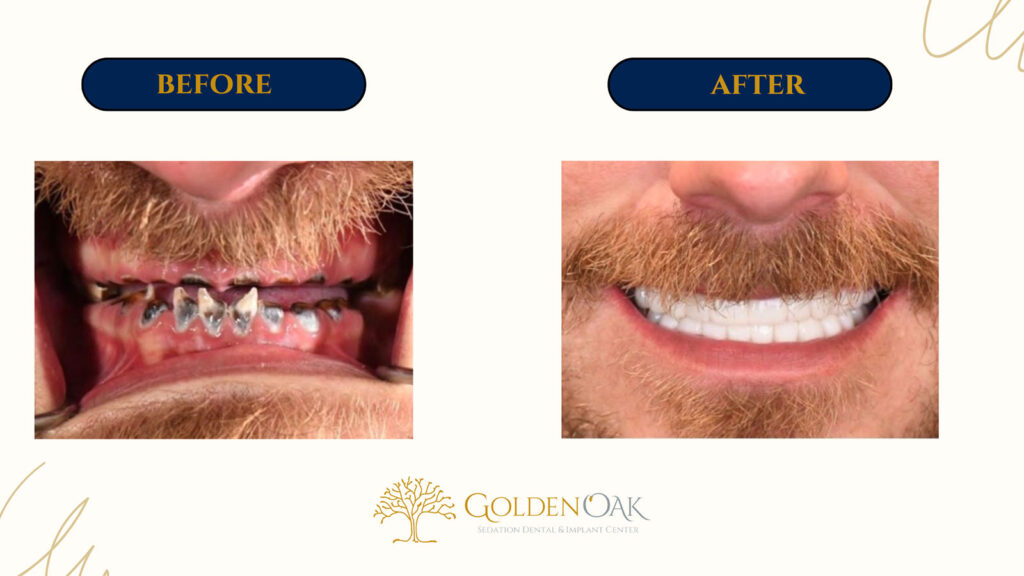 before and after procedure case results