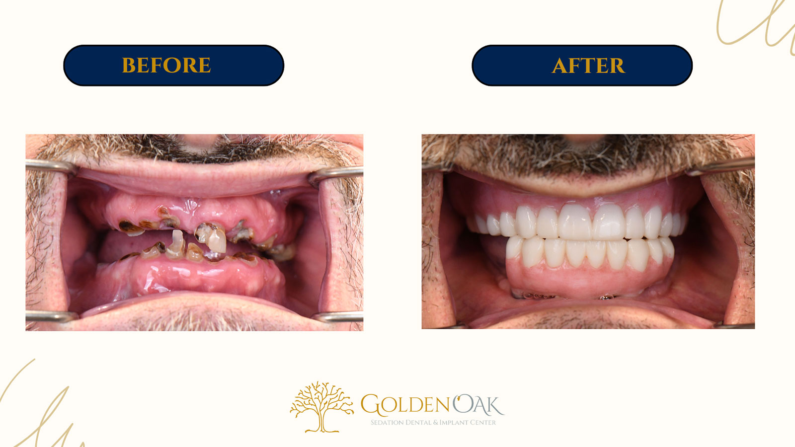before and after procedure case results