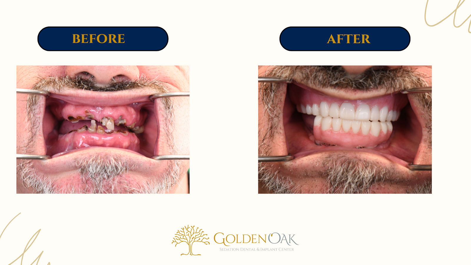 before and after procedure case results