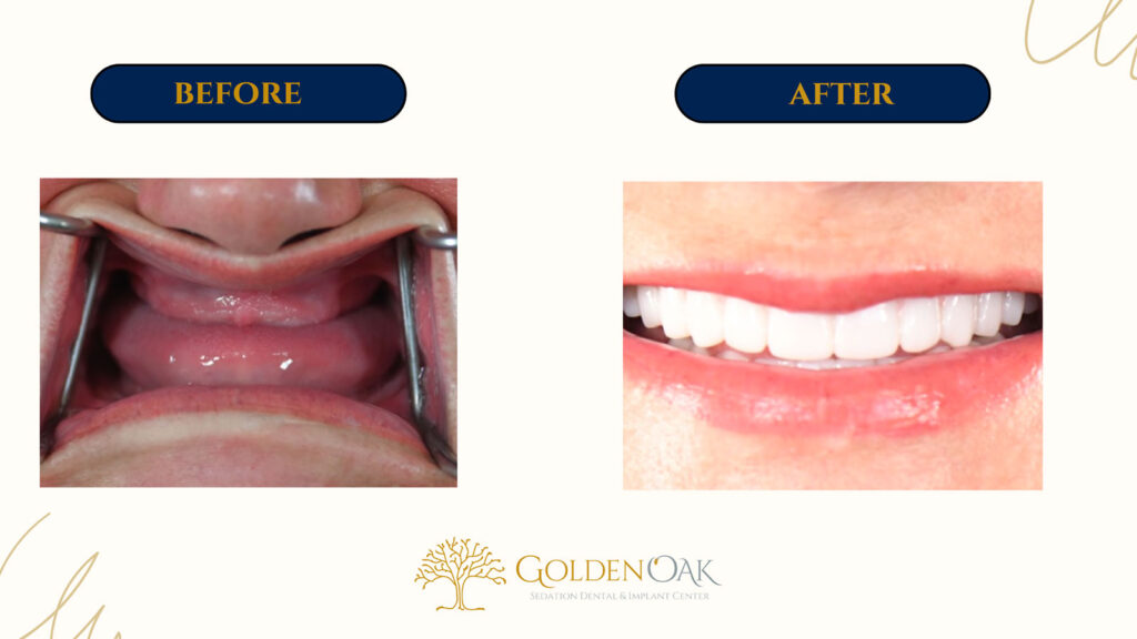 before and after procedure case results