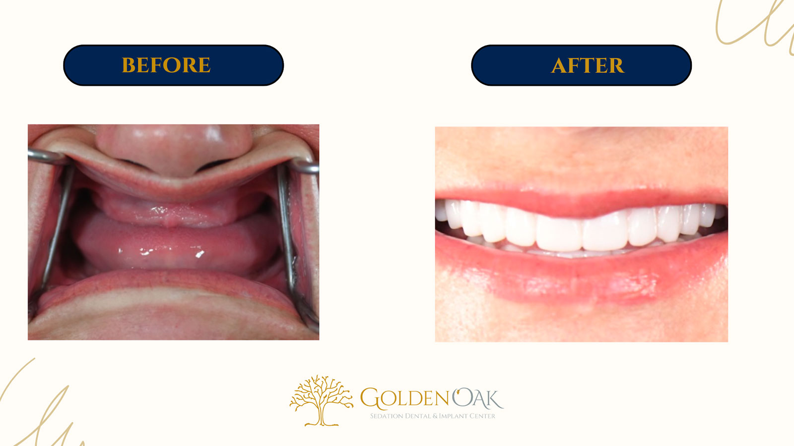 before and after procedure case results