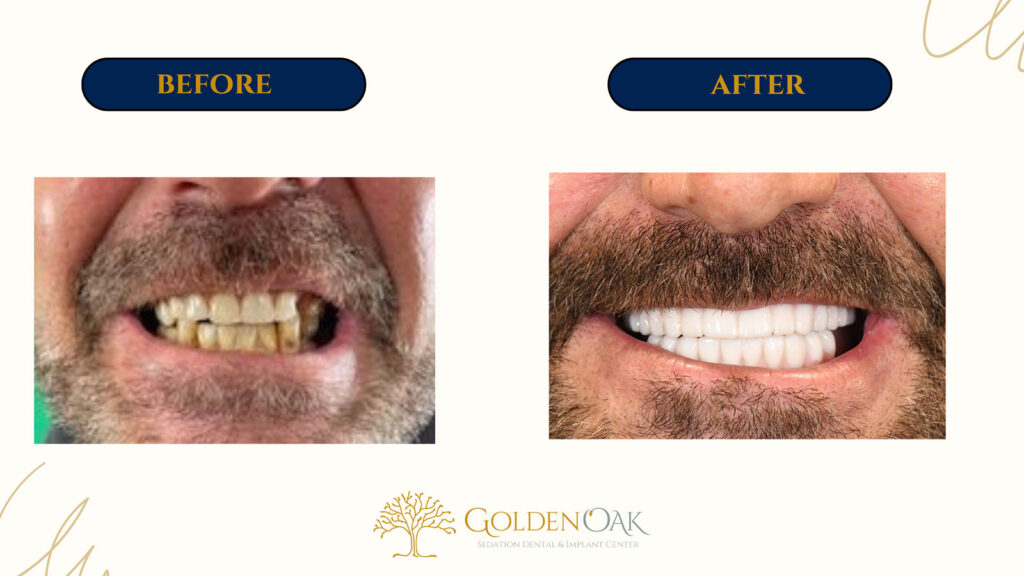 before and after procedure case results