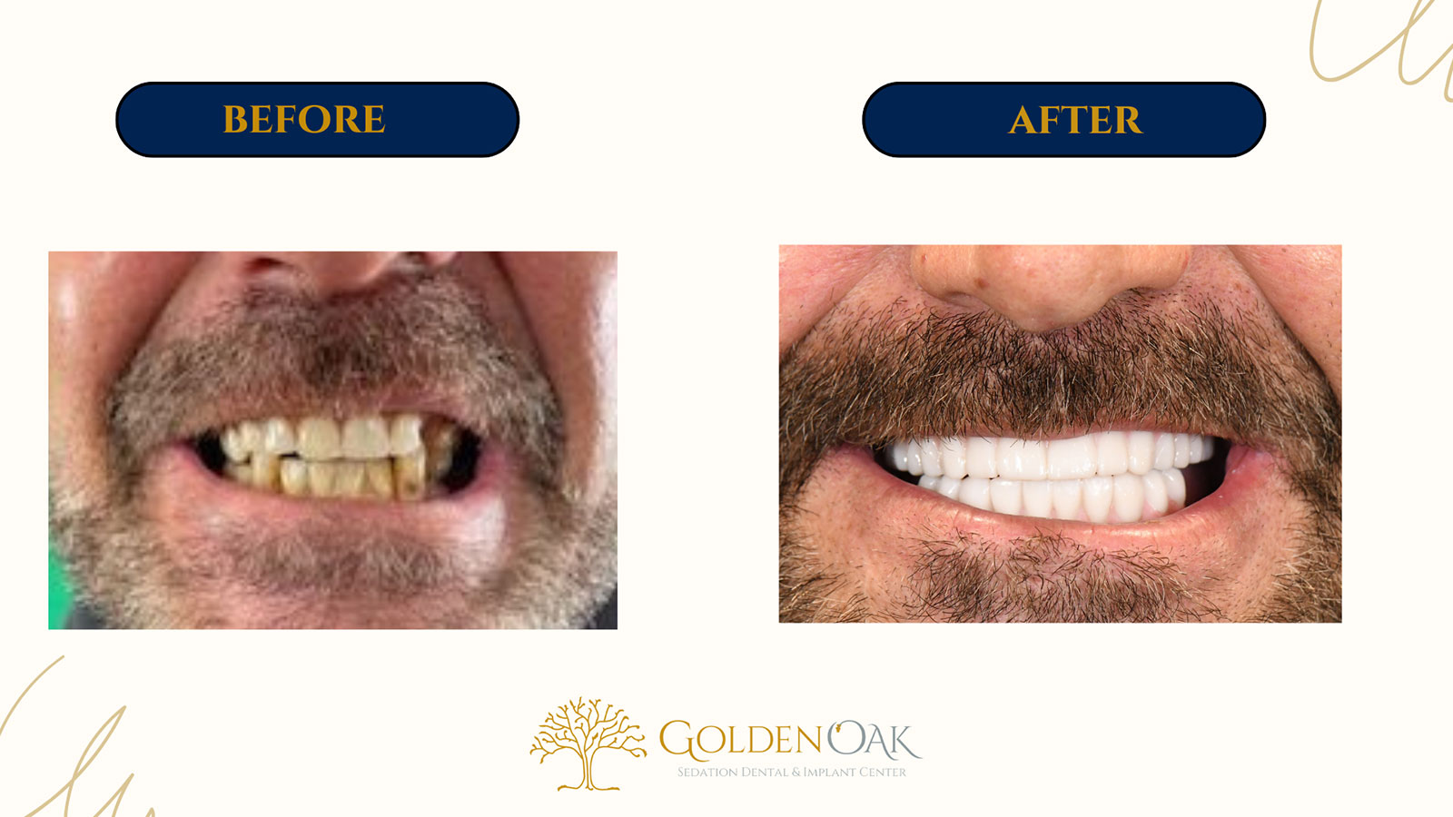 before and after procedure case results