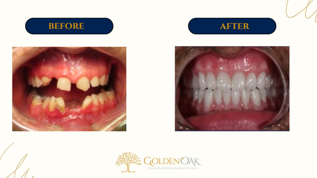 before and after procedure case results