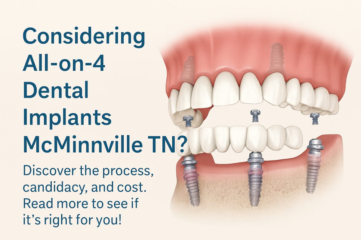 All On 4 Dental Implants: What You Need To Know By McMinnville